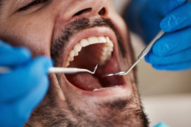 Best Pediatric Emergency Dentist in Sauk Vlage, IL